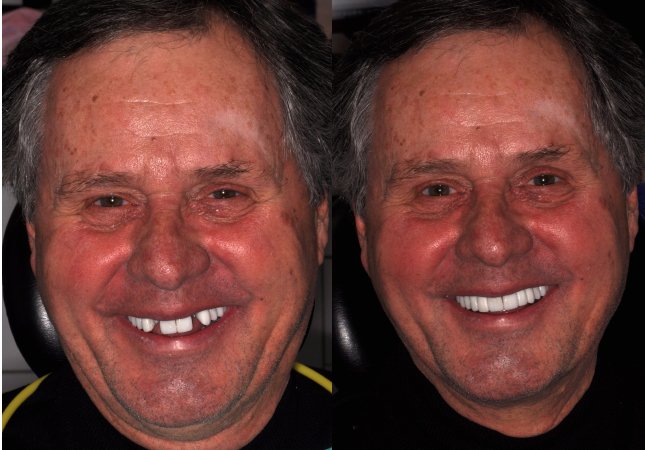 before and after treatment