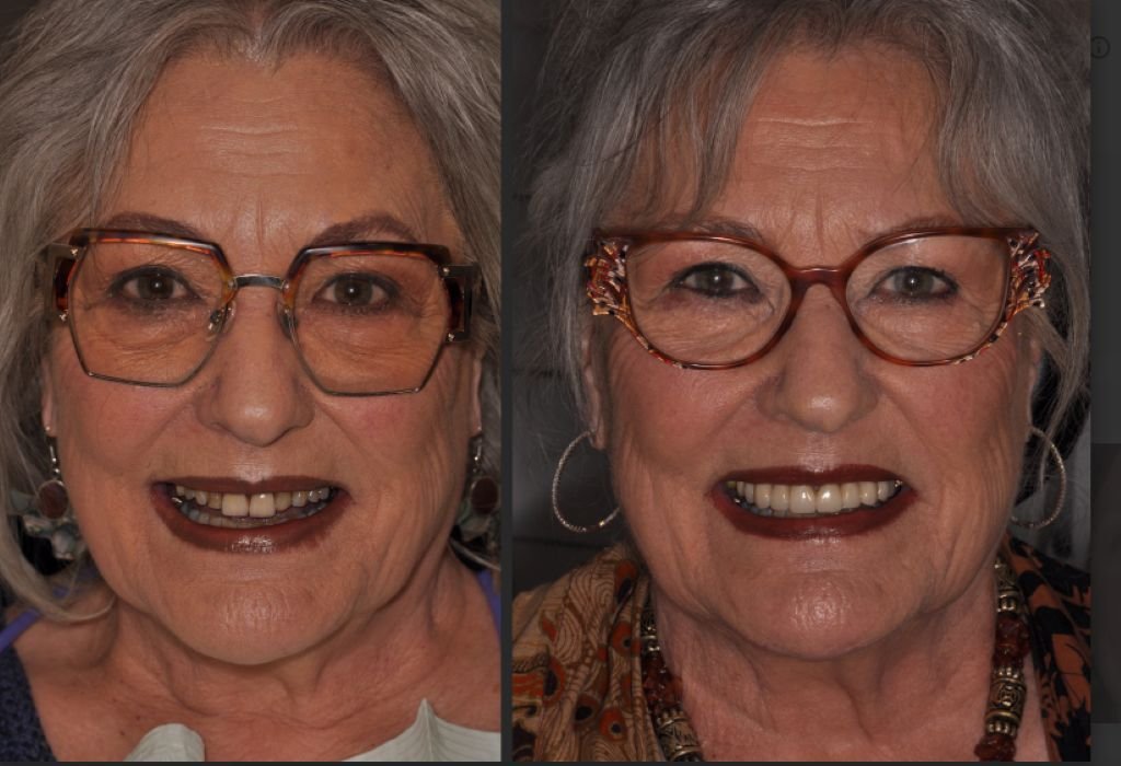 dental patient before and after in calgary