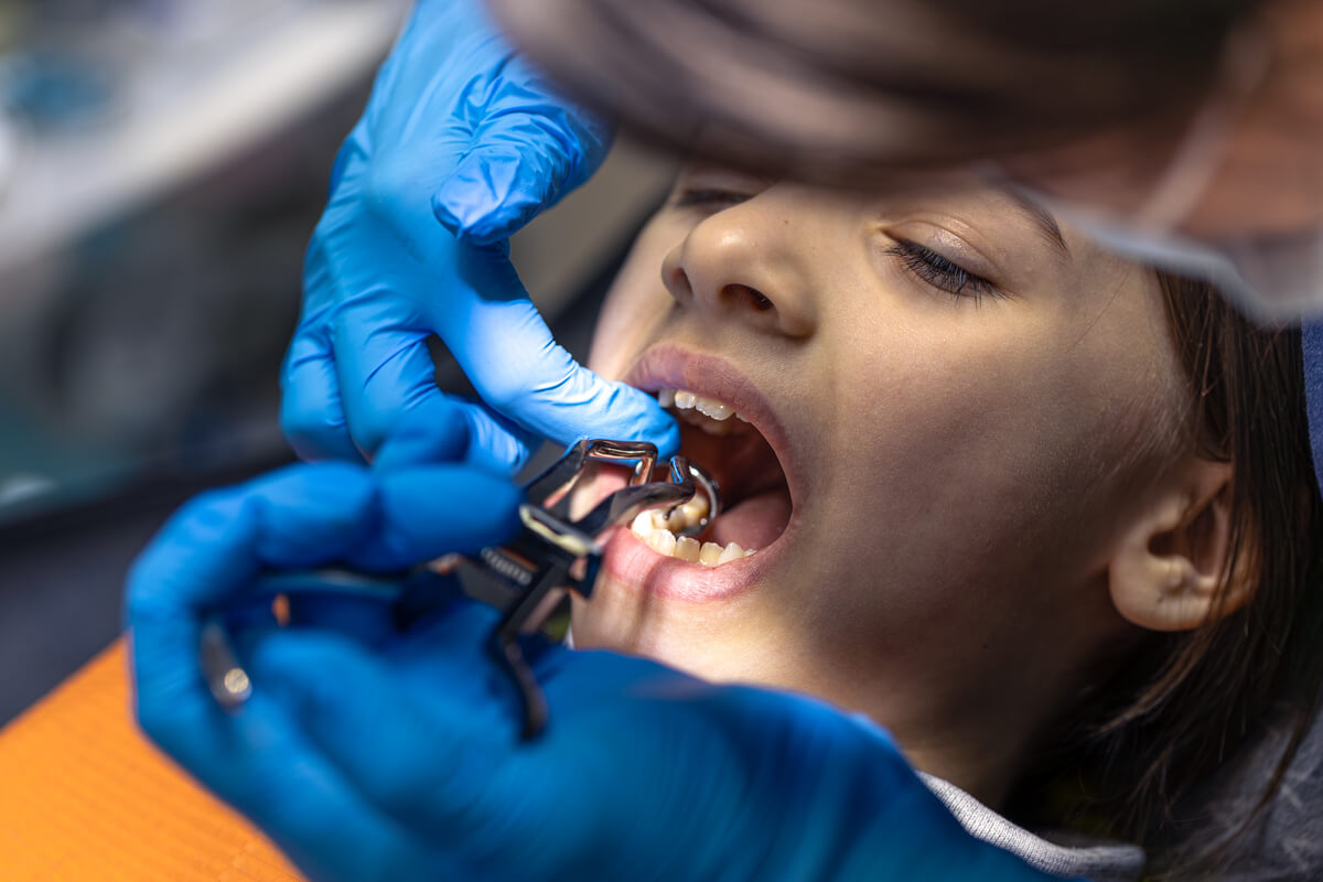at what point is a tooth extraction necessary? exploring the reasons