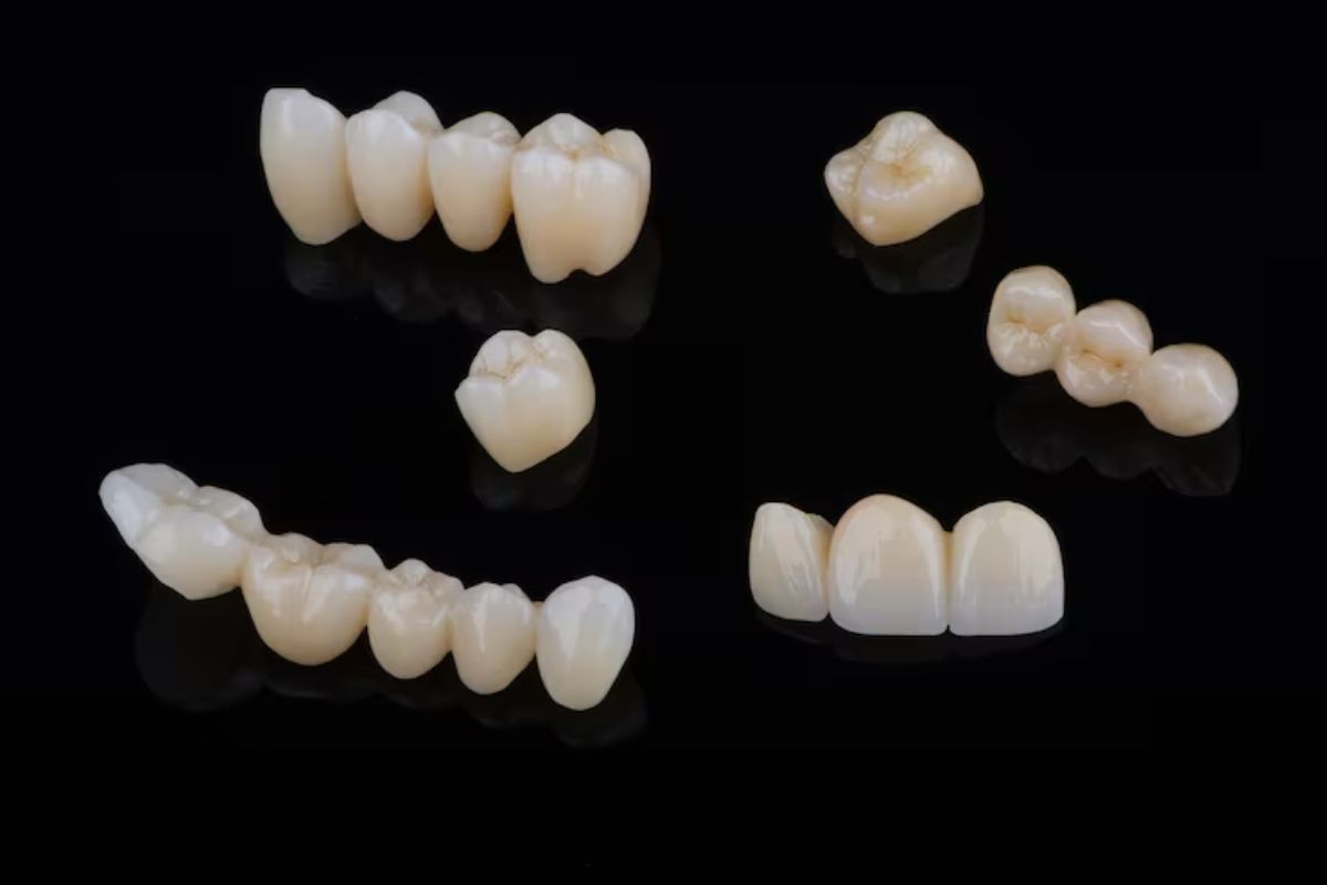 dental bridges for restoring missing teeth and smile function